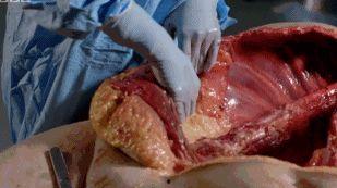 解剖室视频吃瓜